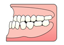 反対咬合（受け口） [はんたいこうごう]