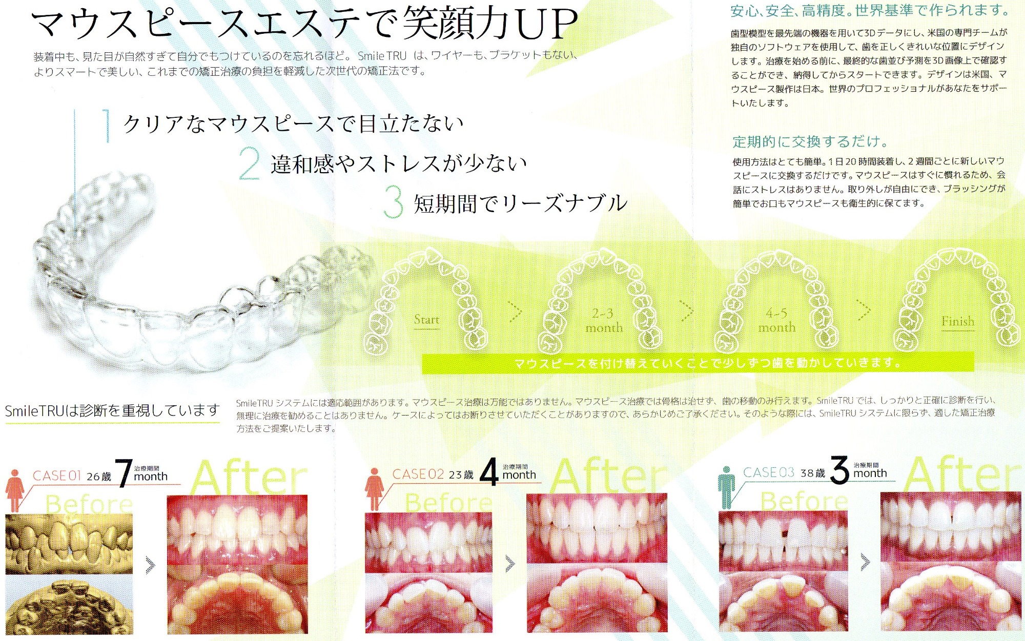 画像：マウスピースエステで笑顔力UP